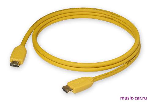 Цифровой кабель HDMI DAXX R36-15